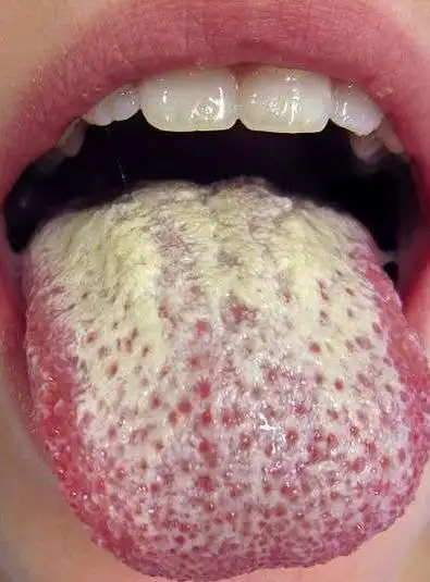 如果有「这些状况」最好去找医生检查!