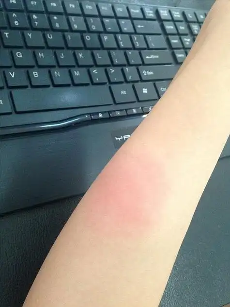 被偷偷亲了一口之后,感觉整个胳膊都不好了.残忍上图