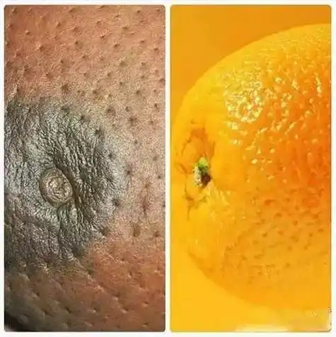 腋下痛,要想到乳腺癌的可能,乳腺癌早期,其症状往往并不明显,但因为