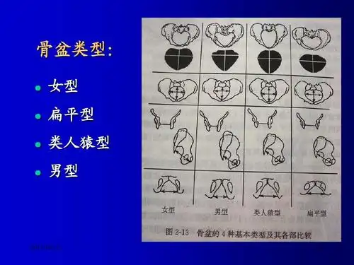 妇产 骨盆类型: ● ● 女型 扁平型 ● ●  类人猿型 男型 2011-02-21