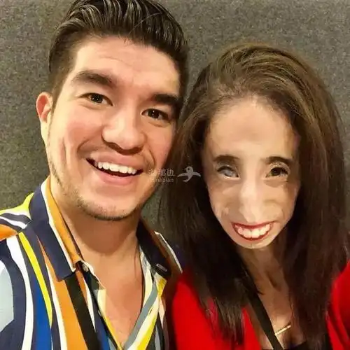 她被骂"全世界最丑的女人",却教会千万人美是什么|海那边海外社区