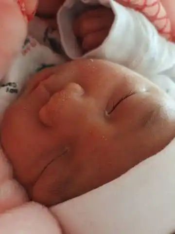 宝宝额头新长出了这个白点 正常吗