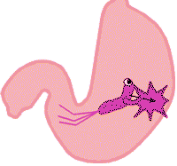 香蕉中含有一种能预防胃溃疡的化学物质5-羟色氨,可舒缓胃酸对胃黏膜