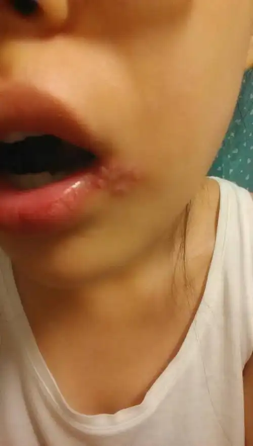 怎么治,?急!一天比一天严重!