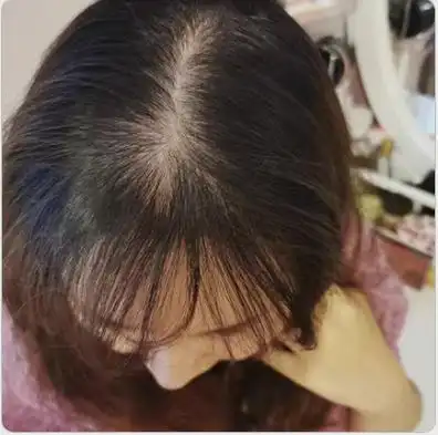 洗发水防脱生发哪个牌子好?脱发用哪个洗发水好