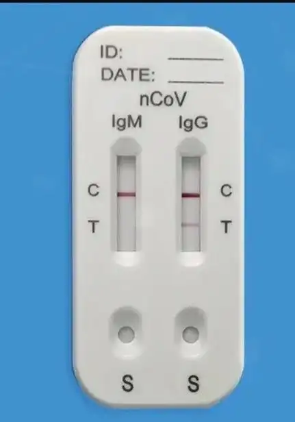67复工复学体检如何选择体检项目快速准确筛查新冠病毒