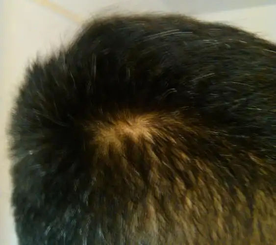 我头发鬓角顶上怎么秃了一块 一个坑一直带着 是斑秃还是怎么回事