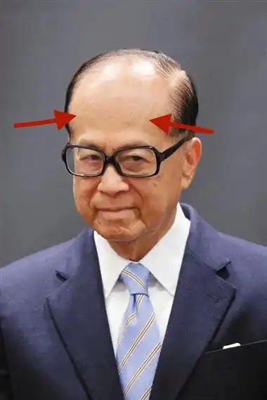 面部九骨之龙角骨