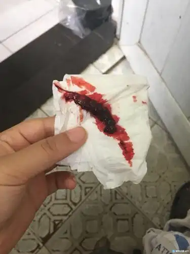 来月经有血块有肉坨是怎么回事