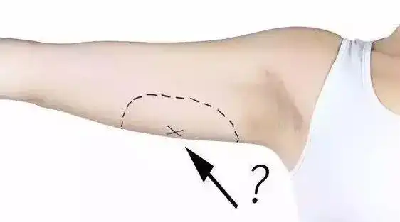 你的手臂下垂松软没有美感如何甩掉拜拜肉