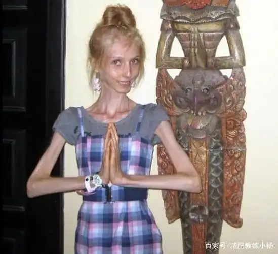 世界上最瘦的人有多瘦?减肥有度,女生不要太执着于瘦的美