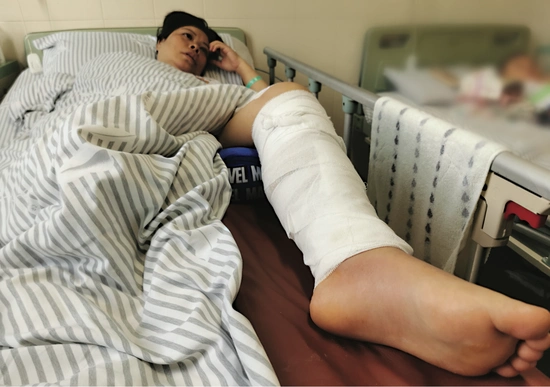 路面水泥未干市民踩上摔骨折维权遇难题难道这一跤白摔了