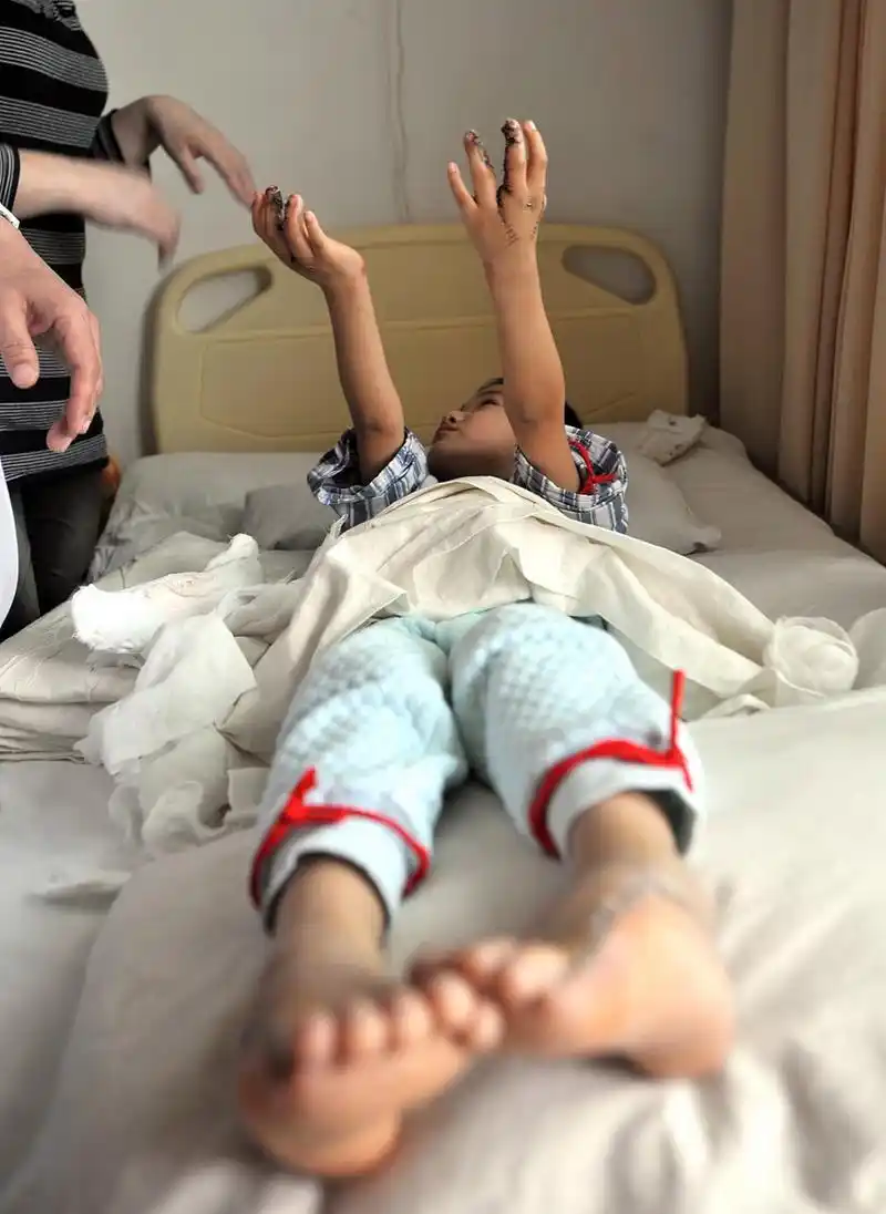 夹腿综合征是病吗	夹腿综合征一般不是病.