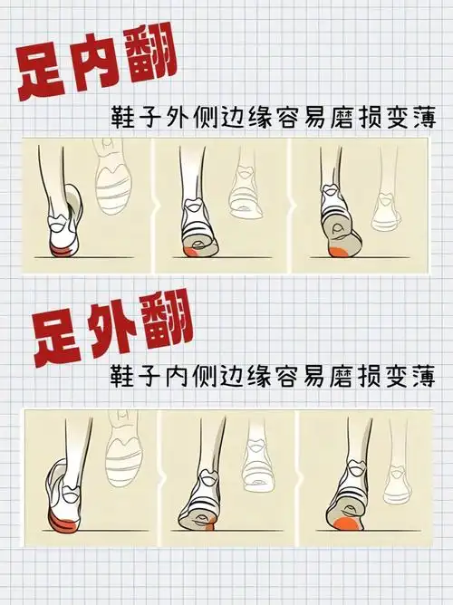 怎么判断足内翻还是外翻?
