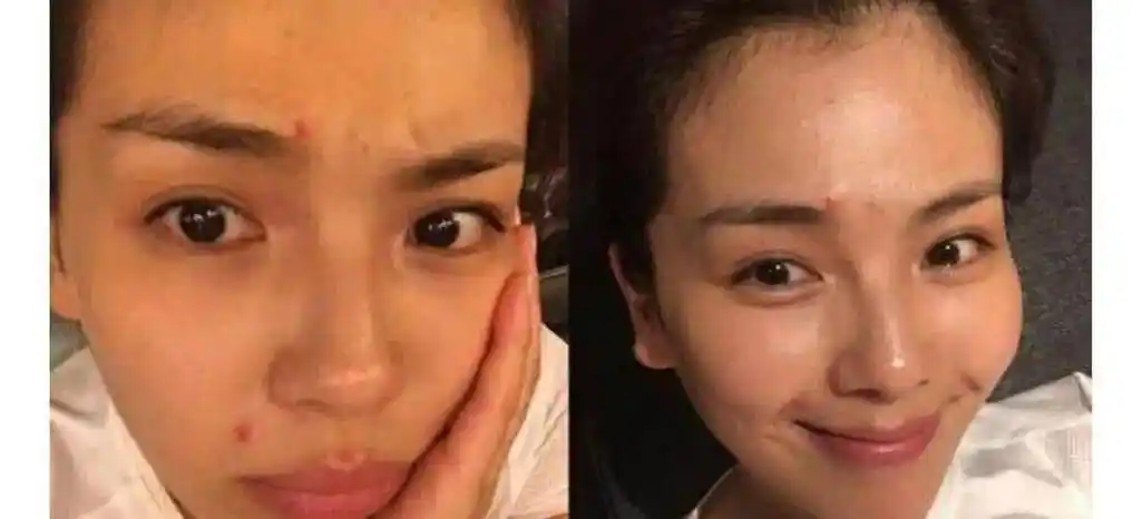 果然,明星卸妆后和真人真的差距很大_杨幂_照片_皮肤