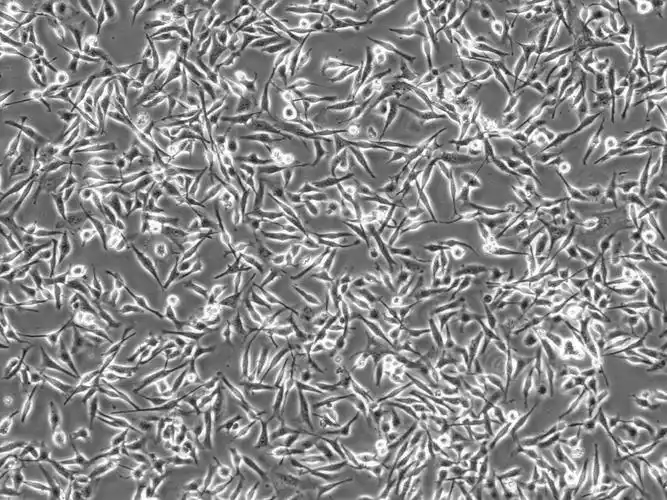 b16小鼠黑色素瘤细胞