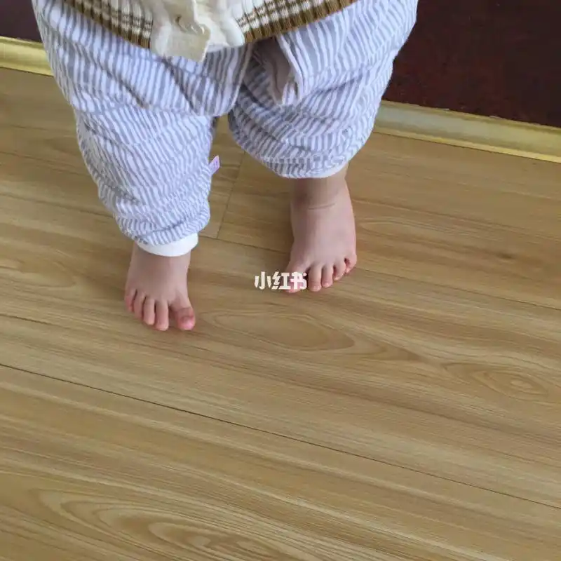 我家宝宝走路脚指头这个样子正常吗