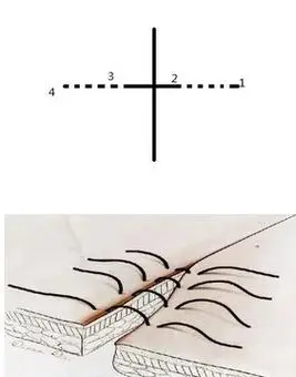 内翻缝合注意要点:1)记得让助手收线2)其他要点同单纯间断缝合三,外翻