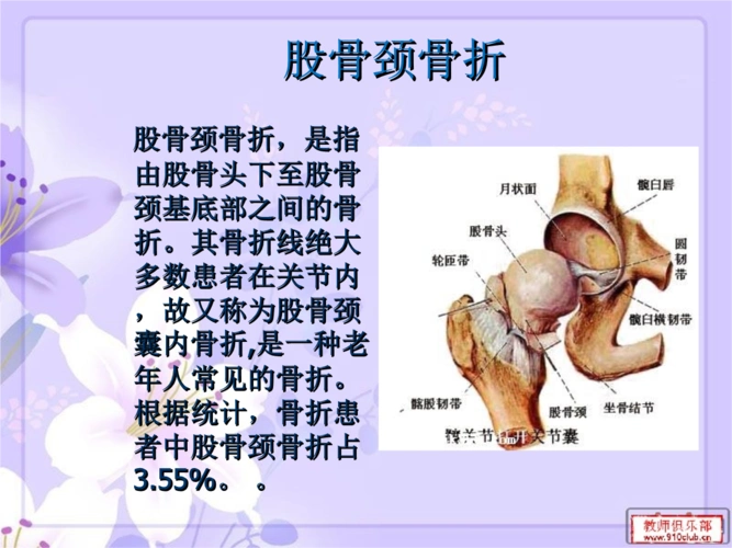 股骨颈骨折幻灯ppt课件.ppt