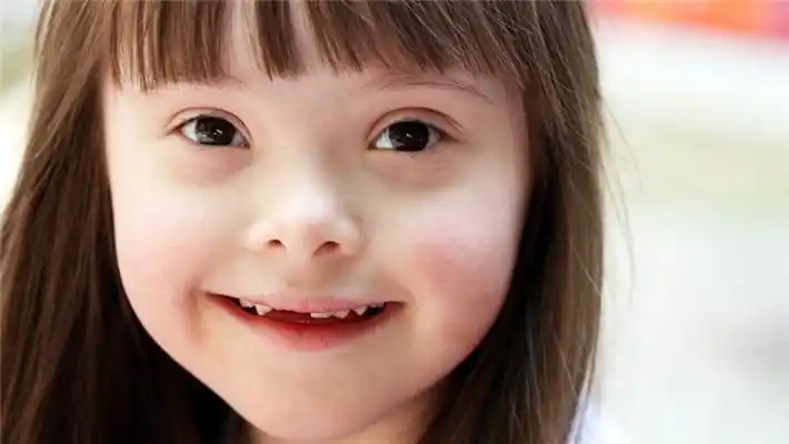 唐氏儿图片 (24)