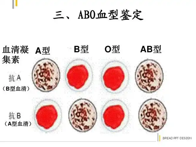 abo血型鉴定 血清凝 aa型 集素 b型 o型 ab型 bc d (b型血清) (a型血