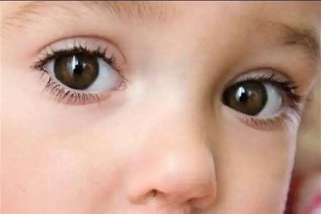 宝宝经常揉眼睛除了犯困还可能是5个原因引起家长别大意