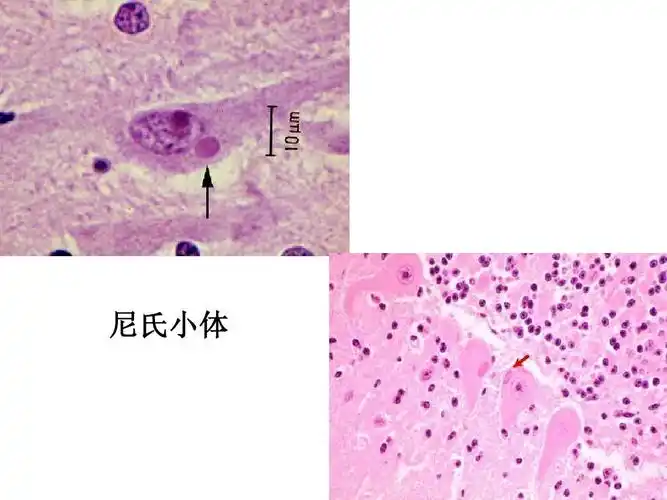 尼氏小体