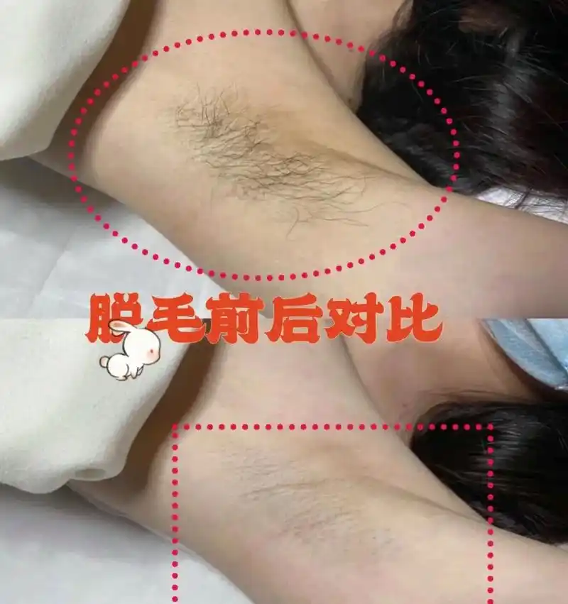 脱毛单次体验28.8 "千万不要脱毛,不然你真的不会知道 自 - 抖音