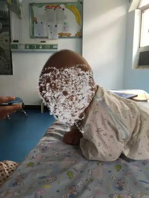 竖头cbobath疗法及在脑瘫患儿中的应用