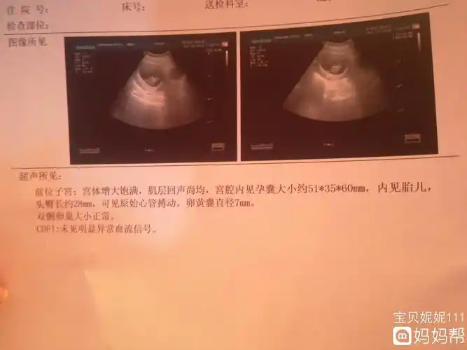 第一个星期怀孕的一些常见症状,你可以参考,看看你是否怀孕 1月经周期