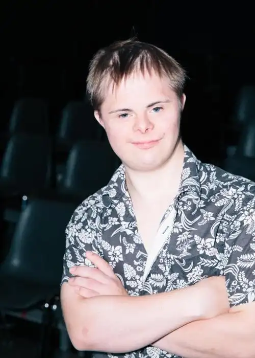 我们替你问了你总想问唐氏综合症患者的十个问题