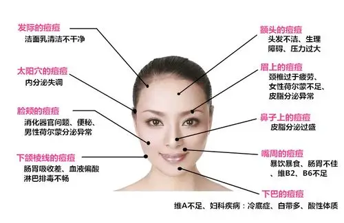 也很规律可还是会冒痘痘 追答: 我发给你的痘痘局部分布图看到了吗?