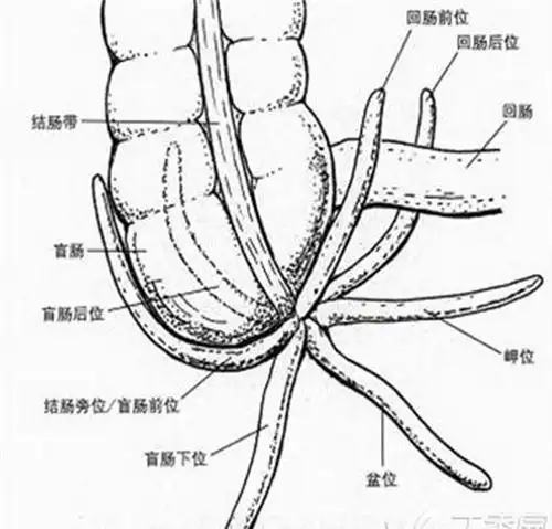阑尾炎表位置通常在麦氏点