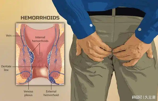 菊花残满地伤10男9痔的痔疮却是人类进步的标志