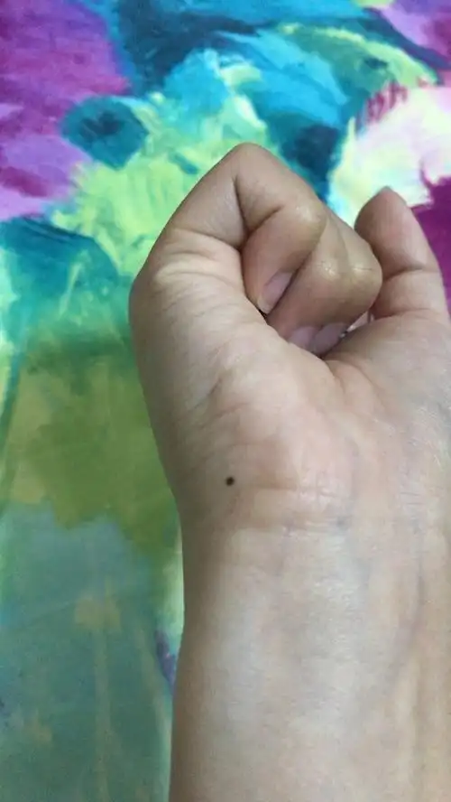 请问女生右手这个位置长痣表示什么意思 最近才长的