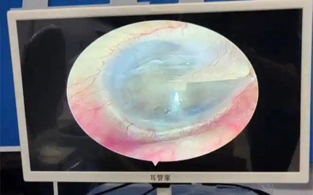 c01超高清可视采耳仪器专业可视采仪器/设备可视采耳免费培训户外专用