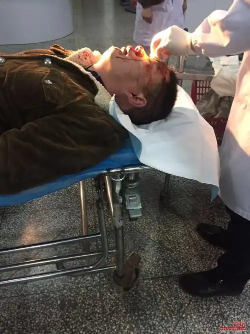 峰汇国际物业打人真相有图片为证