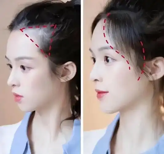 胎毛刘海容易油腻?教你这几招!让你显嫩还好看!一起来学学吧