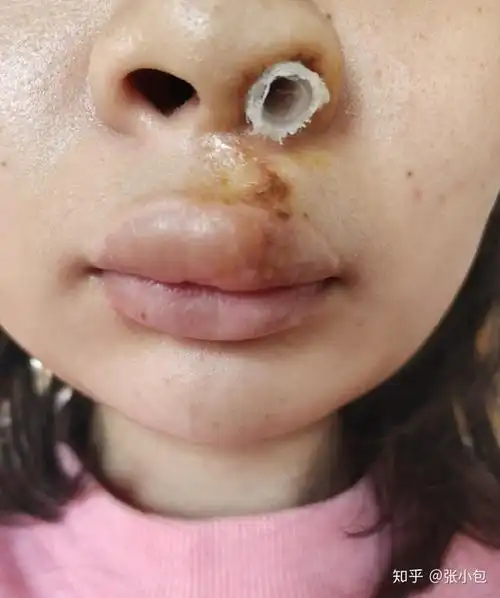 修复第十天 - 知乎