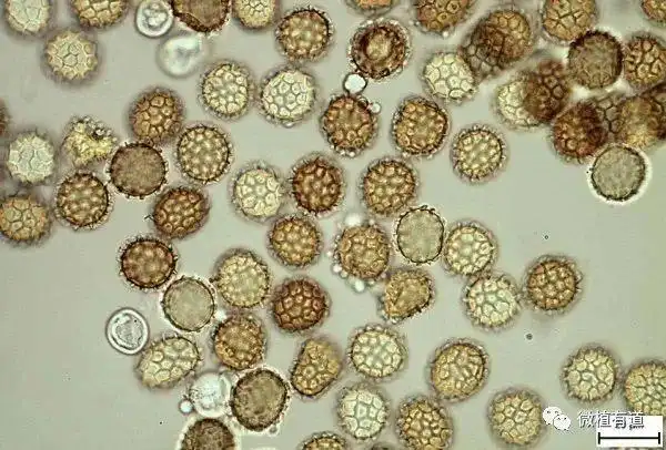 tck冬孢子形态小麦矮腥黑穗病检疫处理依据上述方法,若在口岸成功拦截