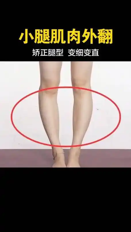 小腿肌肉外翻,像括号一样难看,两个动作帮你快速改善.