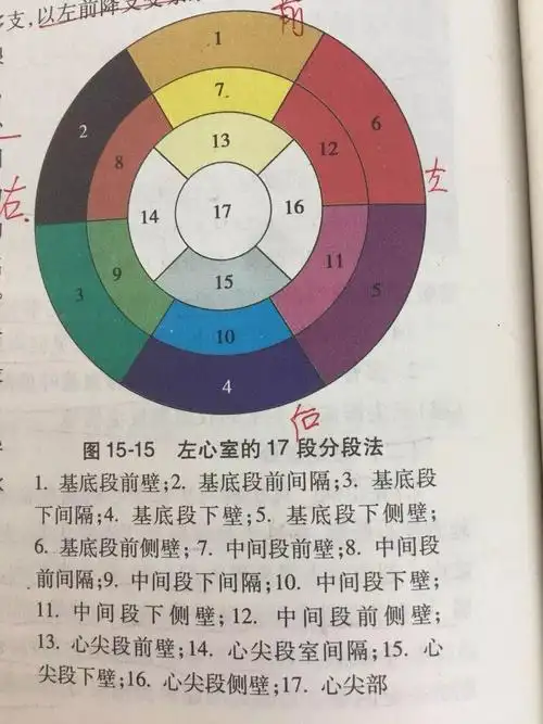 目前根据美国心脏病学会建议,采用17节段 分类法,定位及命名采用左