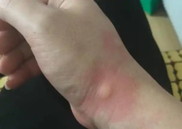 九成人都不晓得蚊子"天敌"是啥?家里放它,仅要5分钟,蚊子跑光