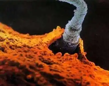 瑞典摄影家实拍人体内受孕的全过程