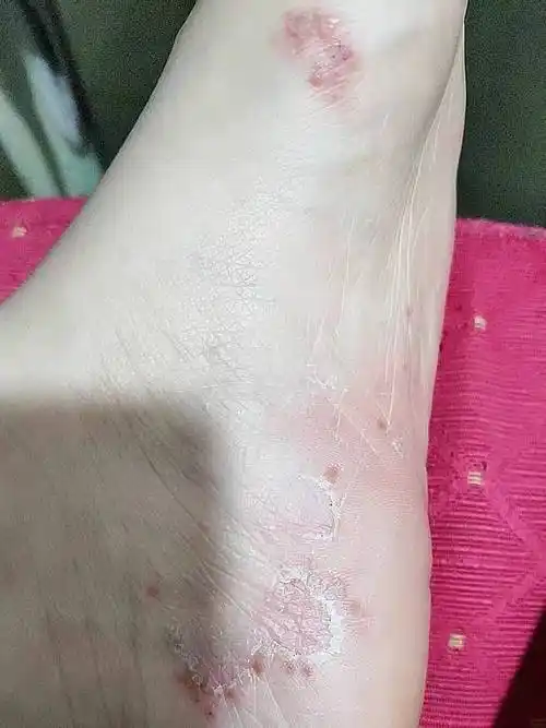 好用到离谱的热门平价脚气产品真实测试分享,一定不