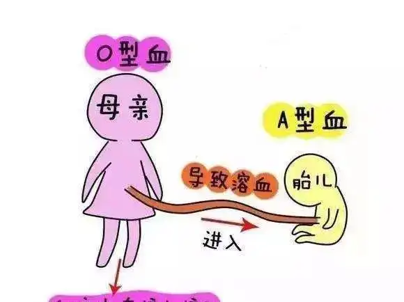 溶血检查-溶血症常见的症状有哪些?