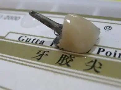 口腔牙体修复中桩冠和桩核冠的区别