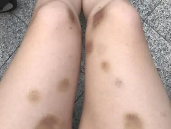 女子装探头拍下被家暴过程 前夫:她自愿的