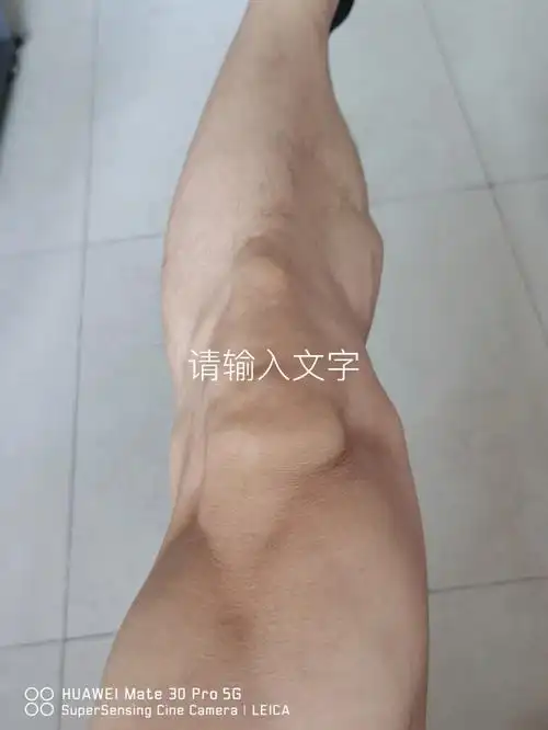 这样的膝关节正常吗