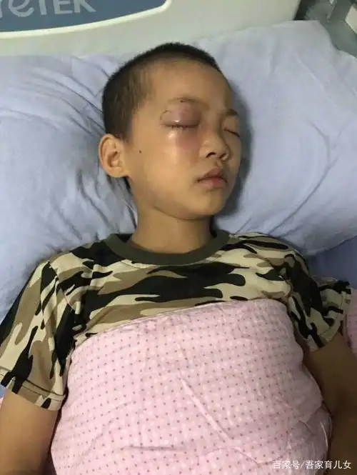 8岁男童眼睛被毁,看似不起眼的东西,却成为身边的"定时炸弹"